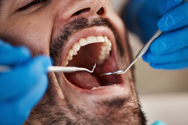 Best Orthodontic Emergency Dentist in Dade City, FL